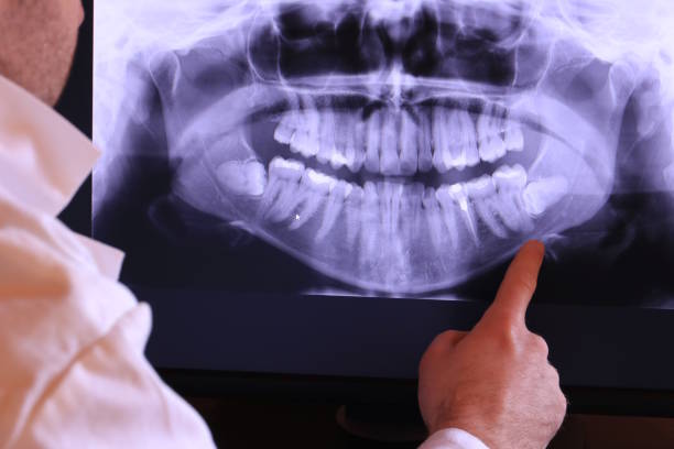 Best Urgent Dental Care for Toothache in Fairfax, OK