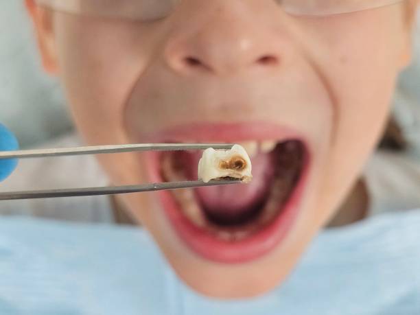 Best Weekend Emergency Dentist in Fairfax, OK